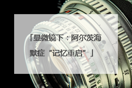 显微镜下：阿尔茨海默症“记忆重启”